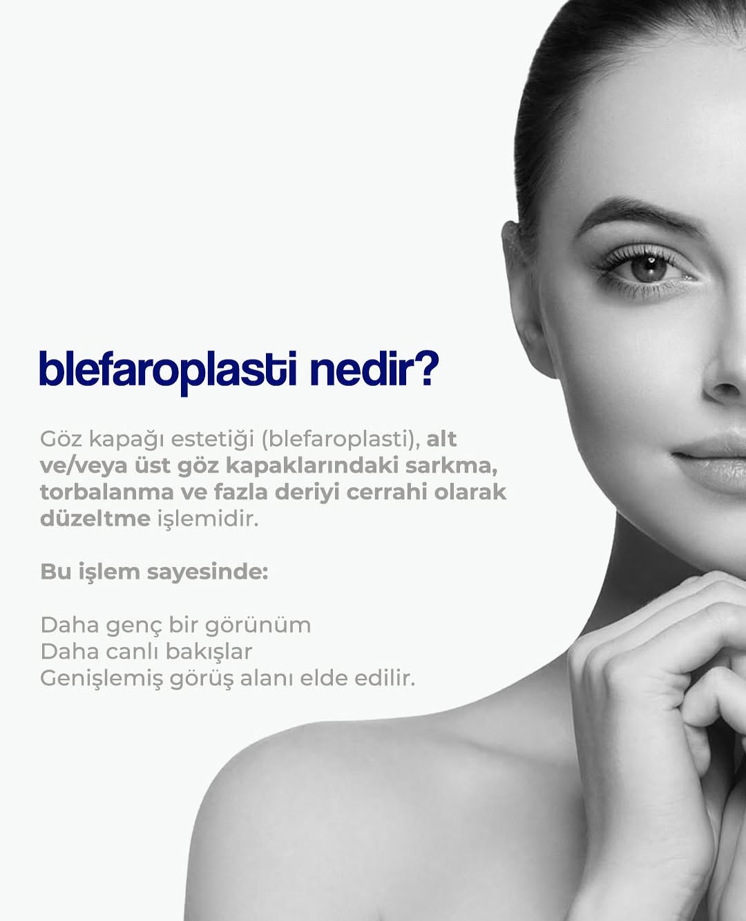 Blefaroplasti Sonuç