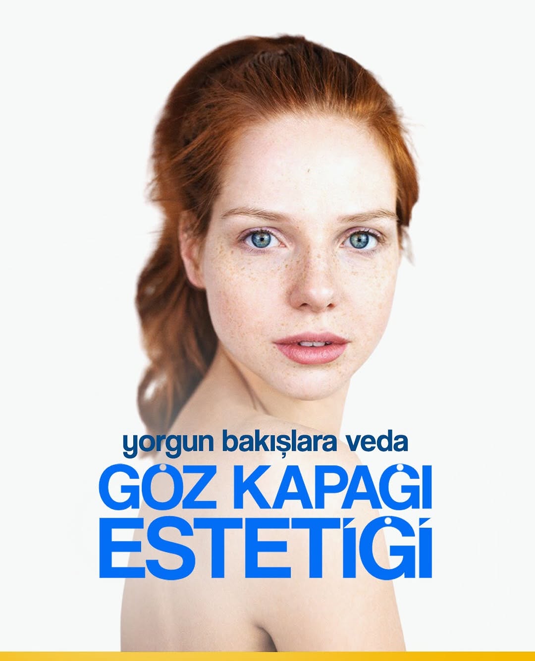 Göz Kapağı Estetiği Blefaroplasti Antalya